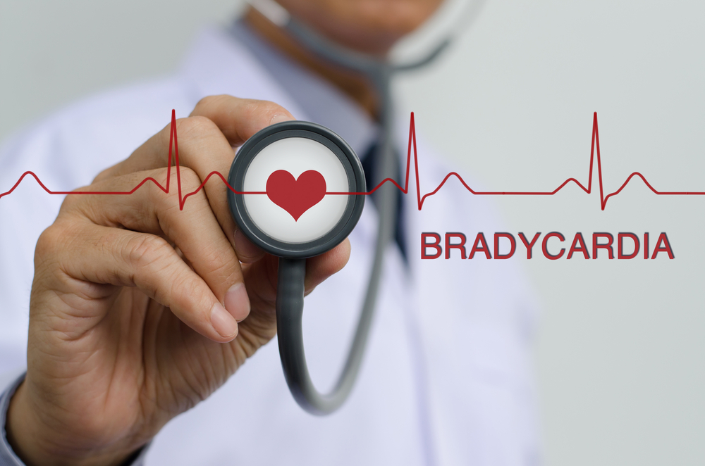 Bradycardia: Symptoms, Causes, and Treatment